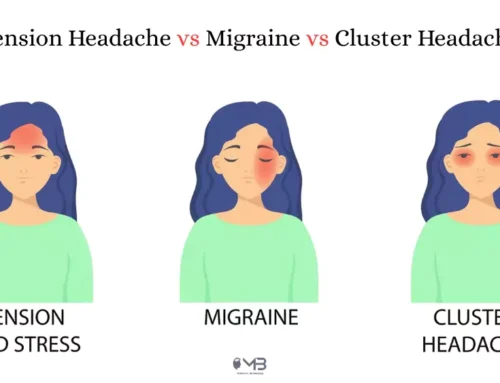 Tension Headache vs Migraine vs Cluster Headache: Key Differences, Symptoms, Causes and Treatment